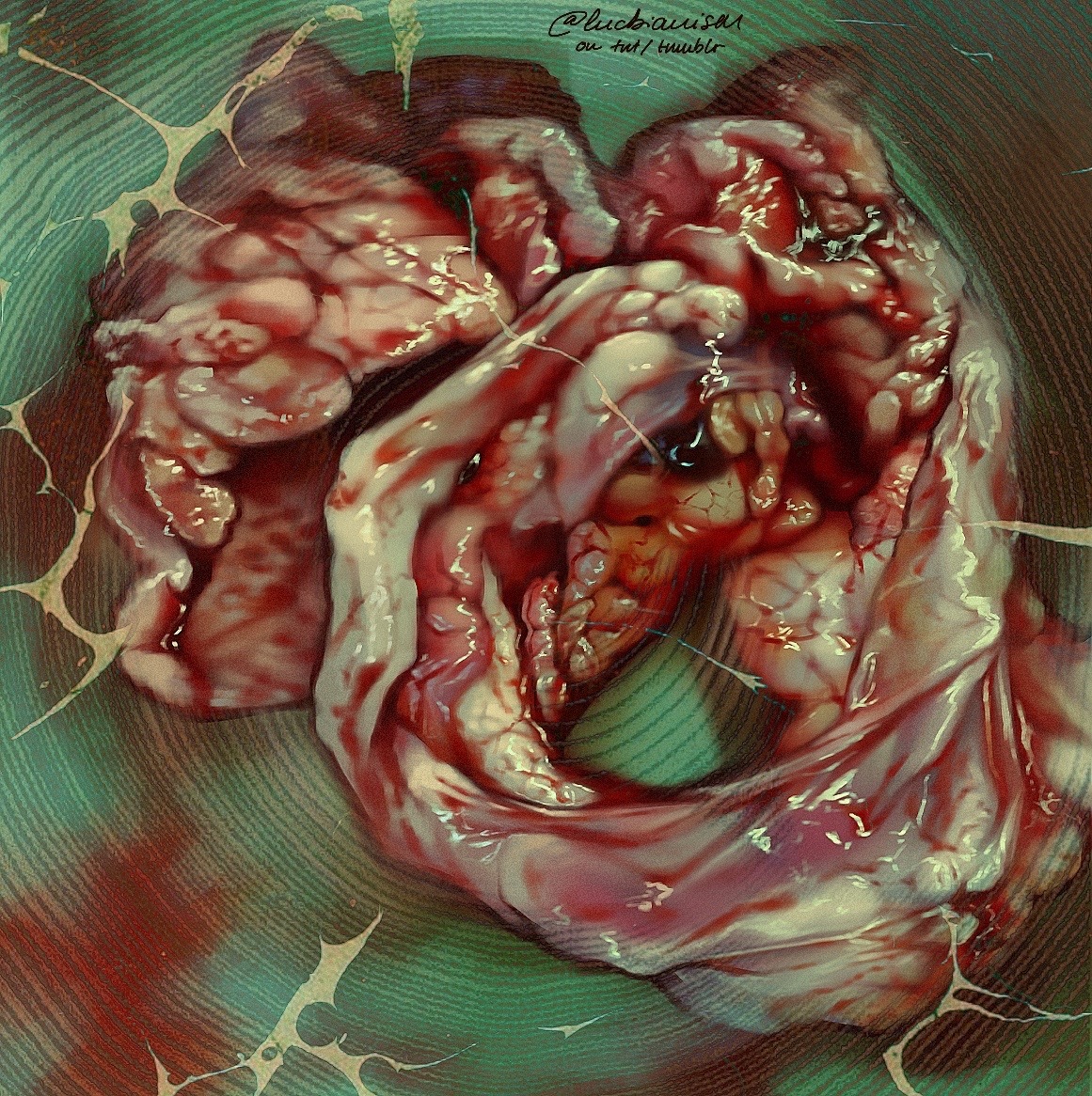 Digital illustration of the outer sack of a pig heart, dissected and laid out on a light green tray. There are parts of the myocardium that was cut alongside with it. The painting aims to showcase the intricate folds and layers of the organ, with overexaggerated lighter symbolising the pericardiul fluid and its thick, reflective texture. There are spots of blood visible in the background, along with clotted blood peeking out from the visible part of the myocardium. On top of the image itself there is an overlayed texture of tree rings and a pattern that resembles lighting, adding more texture to the paiting.